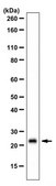 Anti-Chromobox protein homolog 5 Antibody from rabbit, purified by affinity chromatography