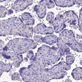 Anti-SLC13A5 antibody produced in rabbit Prestige Antibodies® Powered by Atlas Antibodies, affinity isolated antibody, buffered aqueous glycerol solution