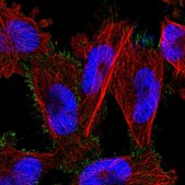 Anti-PARP6 antibody produced in rabbit Prestige Antibodies® Powered by Atlas Antibodies, affinity isolated antibody, buffered aqueous glycerol solution