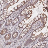 Anti-LRP5 antibody produced in rabbit Prestige Antibodies® Powered by Atlas Antibodies, affinity isolated antibody, buffered aqueous glycerol solution