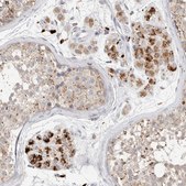 Anti-GGH antibody produced in rabbit Prestige Antibodies® Powered by Atlas Antibodies, affinity isolated antibody, buffered aqueous glycerol solution