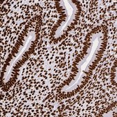Anti-SFPQ antibody produced in rabbit Prestige Antibodies® Powered by Atlas Antibodies, affinity isolated antibody, buffered aqueous glycerol solution