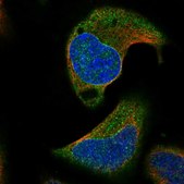 Anti-AARSD1 antibody produced in rabbit Prestige Antibodies® Powered by Atlas Antibodies, affinity isolated antibody, buffered aqueous glycerol solution, Ab2
