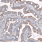 ANTI-TPRN antibody produced in rabbit Prestige Antibodies® Powered by Atlas Antibodies, affinity isolated antibody, buffered aqueous glycerol solution