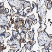 Anti-ITGA6 antibody produced in rabbit Prestige Antibodies® Powered by Atlas Antibodies, affinity isolated antibody, buffered aqueous glycerol solution