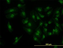 Monoclonal Anti-CDK6 antibody produced in mouse clone 8H4, purified immunoglobulin, buffered aqueous solution