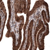 Monoclonal Anti-PFN1 antibody produced in mouse Prestige Antibodies® Powered by Atlas Antibodies, clone CL3524, purified immunoglobulin, buffered aqueous glycerol solution