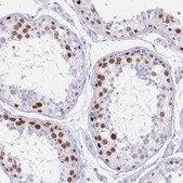 Anti-MAGEC2 antibody produced in rabbit Prestige Antibodies® Powered by Atlas Antibodies, affinity isolated antibody, buffered aqueous glycerol solution