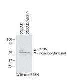 Anti-APP Antibody, AEP-cleaved (373N) serum, from rabbit