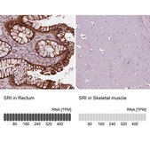 Anti-SRI antibody produced in rabbit Prestige Antibodies® Powered by Atlas Antibodies, affinity isolated antibody