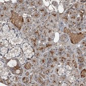Anti-SLC39A8 antibody produced in rabbit Prestige Antibodies® Powered by Atlas Antibodies, affinity isolated antibody, buffered aqueous glycerol solution
