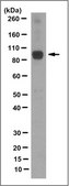 Anti-OSBP Antibody, clone 1A6.2 clone 1A6.2, from mouse
