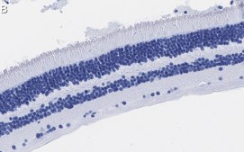 Anti-Recoverin Antibody, clone 1K10 ZooMAb® Rabbit Monoclonal recombinant, expressed in HEK 293 cells