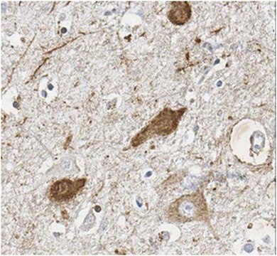 Anticuerpo anti-MAGL from rabbit, purified by affinity chromatography