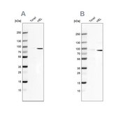 Anti-ARHGAP25 antibody produced in rabbit Prestige Antibodies® Powered by Atlas Antibodies, affinity isolated antibody, buffered aqueous glycerol solution