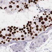 Anti-HIST1H1T antibody produced in rabbit Prestige Antibodies® Powered by Atlas Antibodies, affinity isolated antibody