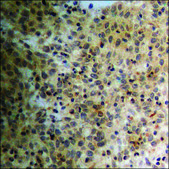 Anti-phospho-PPAR-γ (pSer112) antibody produced in rabbit affinity isolated antibody