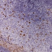 Anti-KLK7 antibody produced in rabbit Prestige Antibodies® Powered by Atlas Antibodies, affinity isolated antibody, buffered aqueous glycerol solution