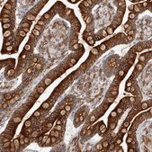 Anti-DHRS7 antibody produced in rabbit Prestige Antibodies® Powered by Atlas Antibodies, affinity isolated antibody, buffered aqueous glycerol solution