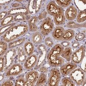 Anti-NUDT6 antibody produced in rabbit Prestige Antibodies® Powered by Atlas Antibodies, affinity isolated antibody, buffered aqueous glycerol solution