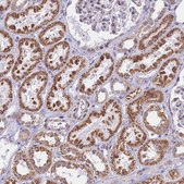Anti-CD3EAP antibody produced in rabbit Prestige Antibodies® Powered by Atlas Antibodies, affinity isolated antibody, buffered aqueous glycerol solution