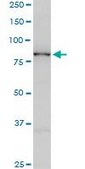 Monoclonal Anti-SMURF1 antibody produced in mouse clone 1D7, purified immunoglobulin, buffered aqueous solution
