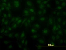 Monoclonal Anti-ARNT antibody produced in mouse clone 3D10, purified immunoglobulin, buffered aqueous solution