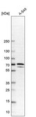 Anti-PDLIM5 antibody produced in rabbit Prestige Antibodies® Powered by Atlas Antibodies, affinity isolated antibody, buffered aqueous glycerol solution