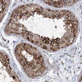 Anti-LARP4B antibody produced in rabbit Prestige Antibodies® Powered by Atlas Antibodies, affinity isolated antibody, buffered aqueous glycerol solution
