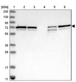 Anti-SNX2 antibody produced in rabbit Prestige Antibodies® Powered by Atlas Antibodies, affinity isolated antibody, buffered aqueous glycerol solution