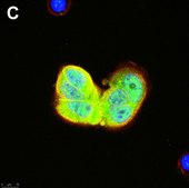 Anti-phospho-ULK1-Ser555 Antibody, clone 1E17 ZooMAb® Rabbit Monoclonal recombinant, expressed in HEK 293 cells