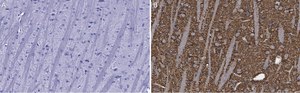 Anti-Synaptophysin Antibody, clone 1G7, ZooMAb® Rabbit Monoclonal recombinant, expressed in HEK 293 cells