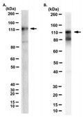 Anti-Pyk2/CAKβ Antibody