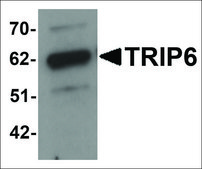 Anti-TRIP6 antibody produced in rabbit affinity isolated antibody, buffered aqueous solution