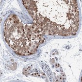 Anti-PSMD13 antibody produced in rabbit Prestige Antibodies® Powered by Atlas Antibodies, affinity isolated antibody, buffered aqueous glycerol solution