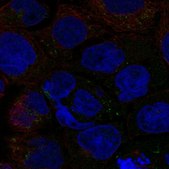 Anti-SLC6A12 antibody produced in rabbit Prestige Antibodies® Powered by Atlas Antibodies, affinity isolated antibody, buffered aqueous glycerol solution