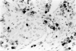 Anti-DNA Antibody, single stranded specific, clone F7-26 clone F7-26, Chemicon®, from mouse