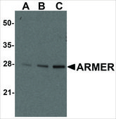Anti-ARMER antibody produced in rabbit affinity isolated antibody, buffered aqueous solution