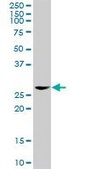Anti-EEF1D antibody produced in rabbit IgG fraction of antiserum, buffered aqueous solution