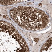 Anti-EPC2 antibody produced in rabbit Prestige Antibodies® Powered by Atlas Antibodies, affinity isolated antibody, buffered aqueous glycerol solution