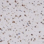 Anti-AKAP9 antibody produced in rabbit Prestige Antibodies® Powered by Atlas Antibodies, affinity isolated antibody, buffered aqueous glycerol solution