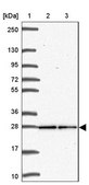 Anti-TSN antibody produced in rabbit Prestige Antibodies® Powered by Atlas Antibodies, affinity isolated antibody, buffered aqueous glycerol solution
