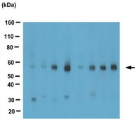 Anti-ACAT-2 Antibody from rabbit, purified by affinity chromatography