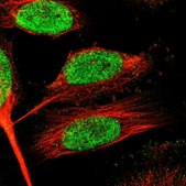 Anti-ZNF24 antibody produced in rabbit Prestige Antibodies® Powered by Atlas Antibodies, affinity isolated antibody, buffered aqueous glycerol solution
