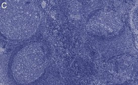 Anti-BCL-6 Antibody, clone 1B7 ZooMAb® Rabbit Monoclonal recombinant, expressed in HEK 293 cells