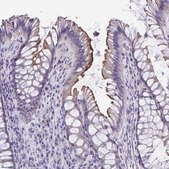 Anti-TMPRSS2 antibody produced in rabbit Prestige Antibodies® Powered by Atlas Antibodies, affinity isolated antibody, buffered aqueous glycerol solution
