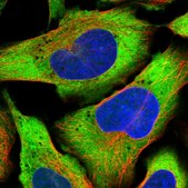 Anti-PDSS2 antibody produced in rabbit Prestige Antibodies® Powered by Atlas Antibodies, affinity isolated antibody, buffered aqueous glycerol solution, ab2