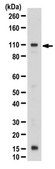 Anti-Kinesin-like protein KIFC3 Antibody from rabbit, purified by affinity chromatography