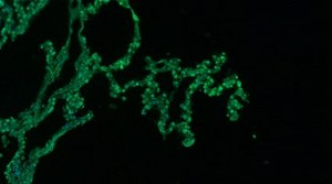 Anti-Surfactant Protein D Antibody, Alexa Fluor™ 488 Conjugate from rabbit, ALEXA FLUOR™ 488
