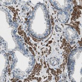 Anti-SVIL antibody produced in rabbit Prestige Antibodies® Powered by Atlas Antibodies, affinity isolated antibody, buffered aqueous glycerol solution, Ab2